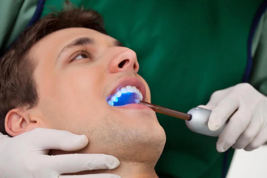 Curing light during tooth repair dental bonding in Mount Holly
