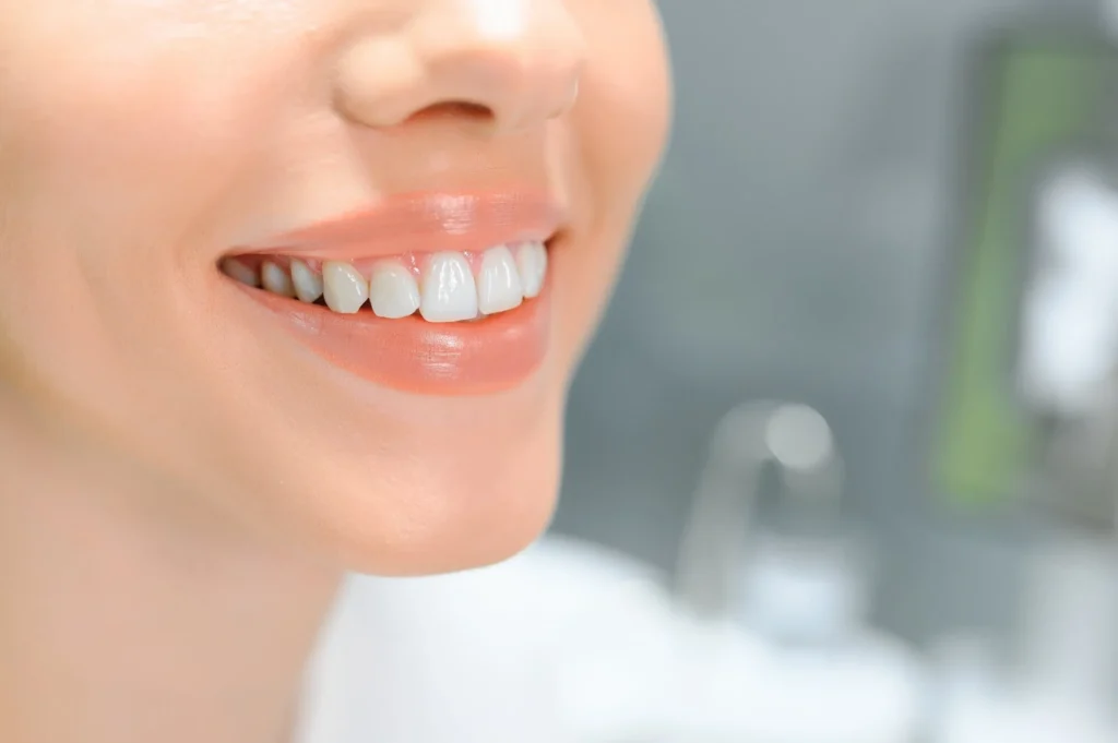 Natural smile with dental bonding in Mount Holly
